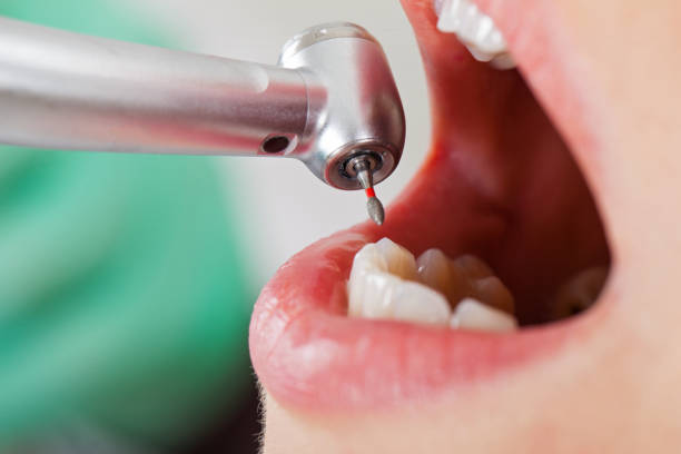 Best Dental Abscess Treatment in Archdale, NC